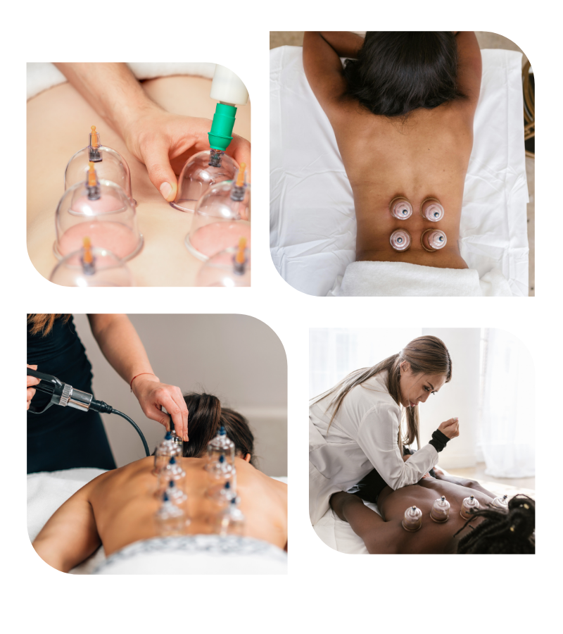 Cupping Therapy benefits