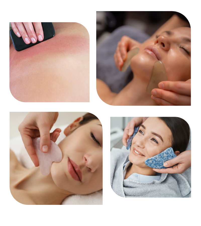 Gua Sha Treatment